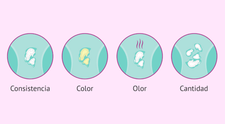 Flujo vaginal anormal